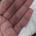 Rambut Rontok Berlebihan? Kenali 7 Penyebab dan Cara Efektif Mencegahnya