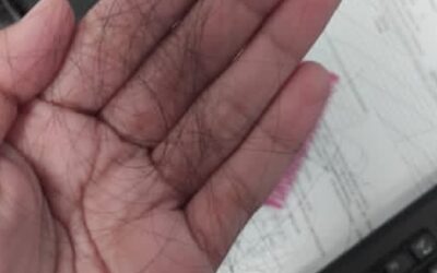 Rambut Rontok Berlebihan? Kenali 7 Penyebab dan Cara Efektif Mencegahnya